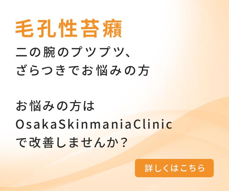 毛孔性苔癬 二の腕のプツプツ、ざらつきでお悩みの方 お悩みの方はOsakaSkinmaniaClinicで改善しませんか?こちらをクリック