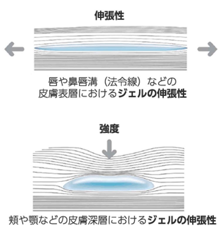 唇や鼻唇溝（ほうれい線）などの皮膚表層におけるジェルの伸縮性、頬や顎などの皮膚深層におけるジェルの伸縮性 図