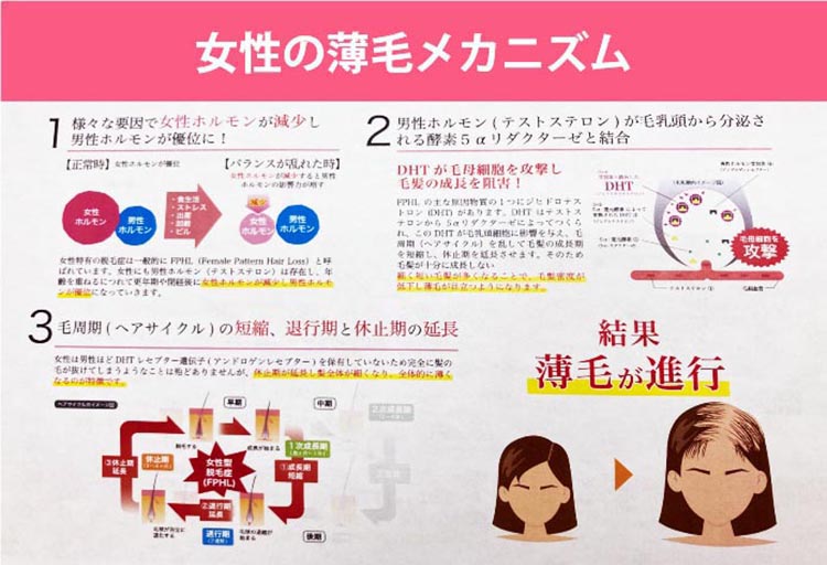 女性の薄毛メカニズム